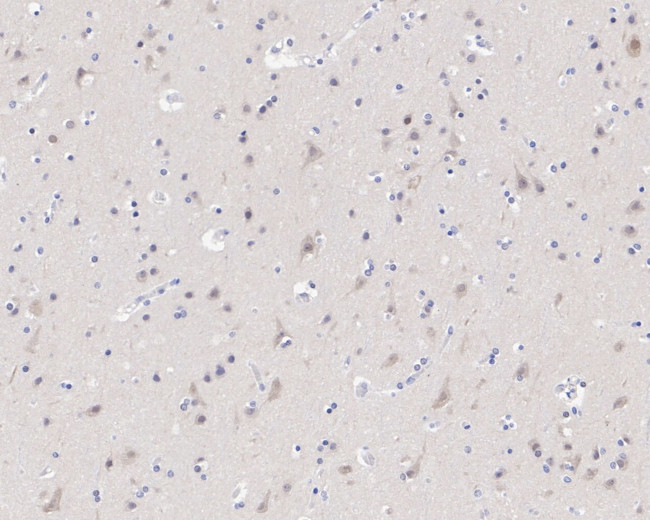 CRBN Antibody in Immunohistochemistry (Paraffin) (IHC (P))