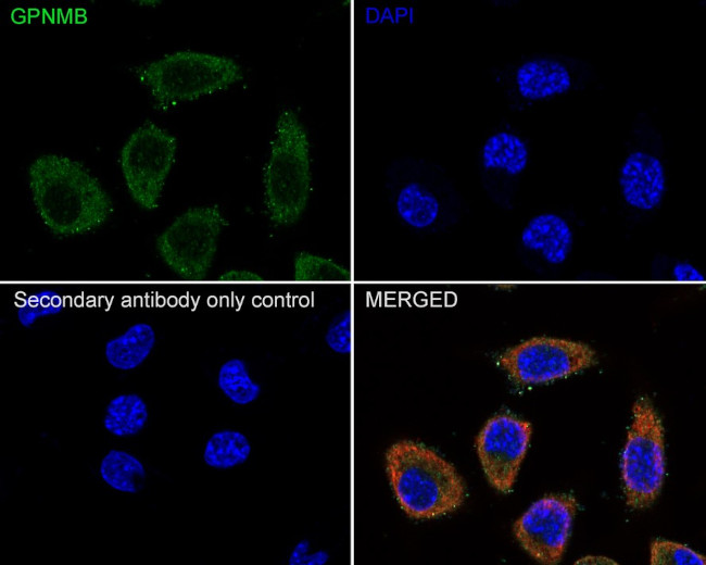 GPNMB Antibody in Immunocytochemistry (ICC/IF)