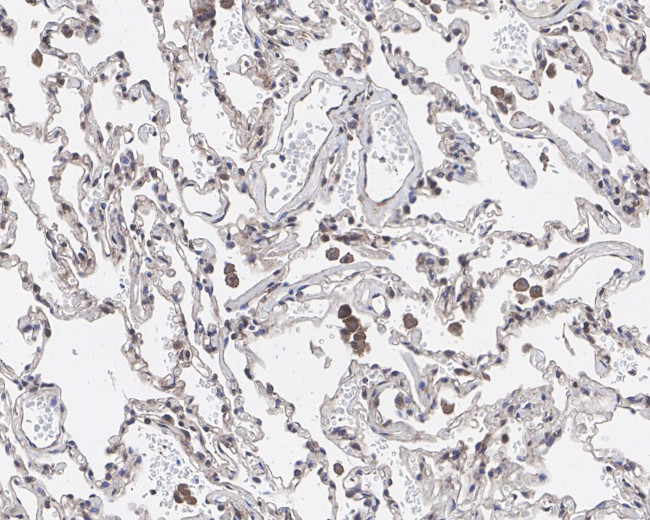 GPNMB Antibody in Immunohistochemistry (Paraffin) (IHC (P))