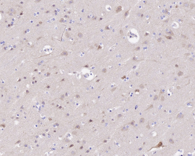 SIAH1 Antibody in Immunohistochemistry (Paraffin) (IHC (P))