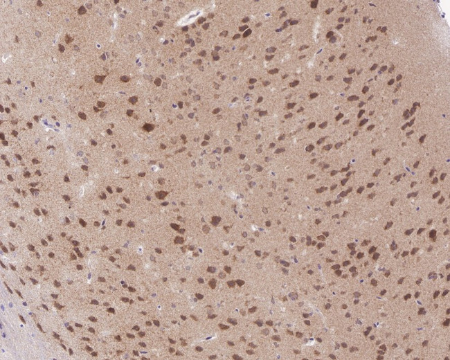 SIAH1 Antibody in Immunohistochemistry (Paraffin) (IHC (P))