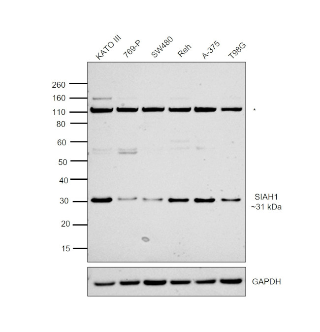 SIAH1 Antibody in Western Blot (WB)