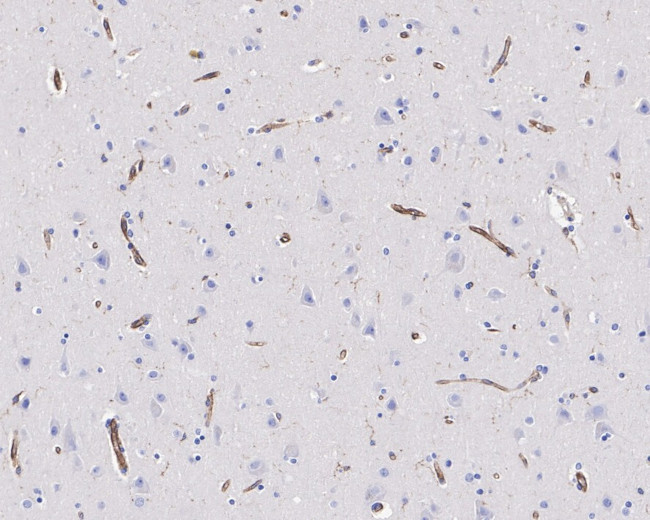 VISTA Antibody in Immunohistochemistry (Paraffin) (IHC (P))