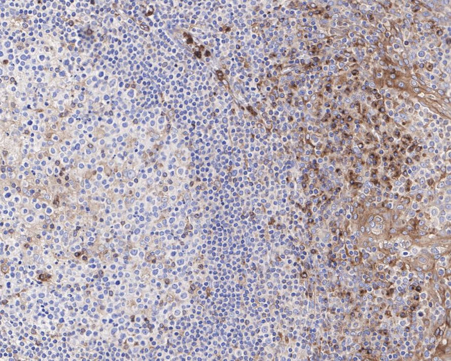 VISTA Antibody in Immunohistochemistry (Paraffin) (IHC (P))