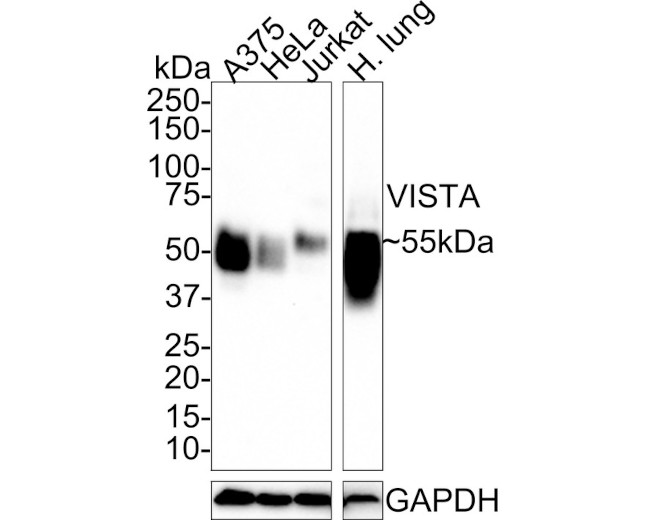 VISTA Antibody in Western Blot (WB)