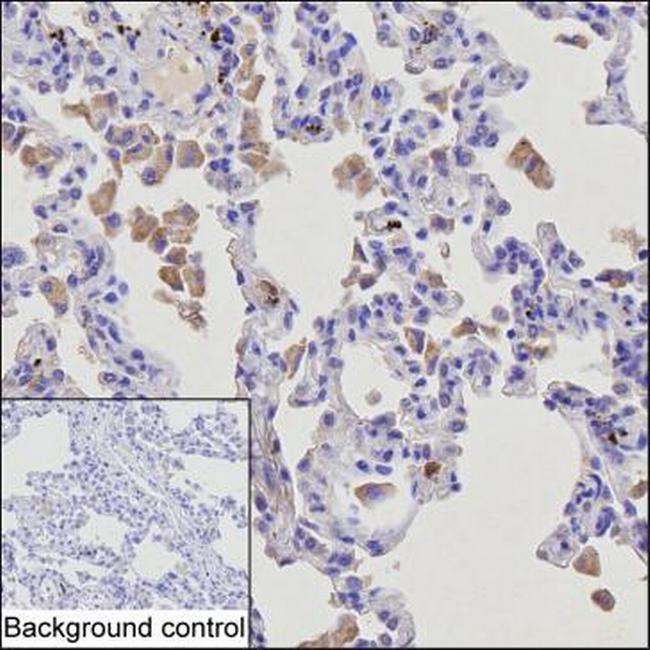 GM-CSF Antibody in Immunohistochemistry (Paraffin) (IHC (P))