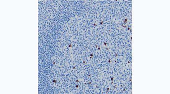 Human IgG3 Antibody in Immunohistochemistry (Paraffin) (IHC (P))