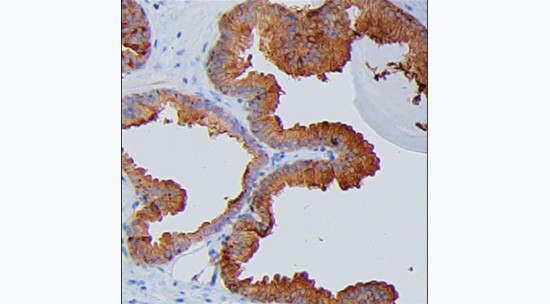 PSA Antibody in Immunohistochemistry (Paraffin) (IHC (P))