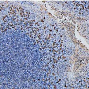 Human IgA Antibody in Immunohistochemistry (Paraffin) (IHC (P))