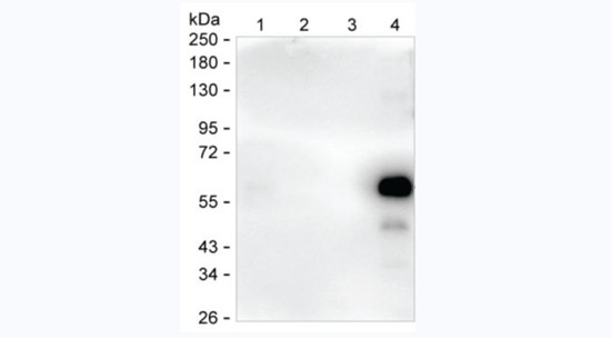 Human IgA Antibody in Western Blot (WB)