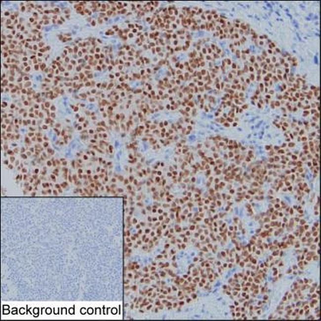 GATA3 Antibody in Immunohistochemistry (Paraffin) (IHC (P))