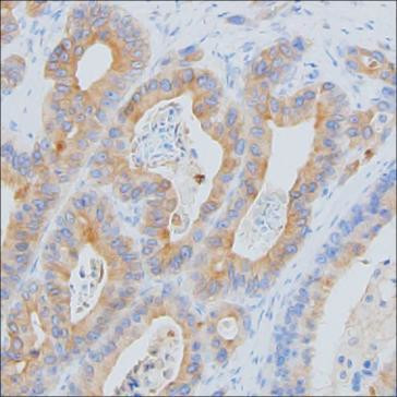 MCP-1 Antibody in Immunohistochemistry (Paraffin) (IHC (P))