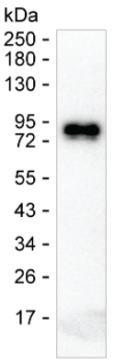 Human IgE Antibody in Western Blot (WB)