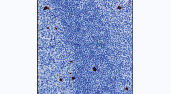 Human IgG4 Antibody in Immunohistochemistry (Paraffin) (IHC (P))