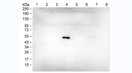 Human IgG4 Antibody in Western Blot (WB)