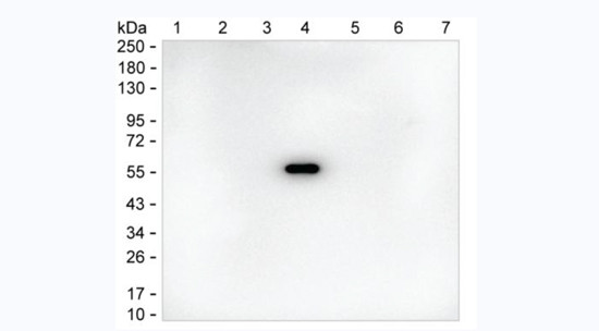 Human IgG4 Antibody in Western Blot (WB)