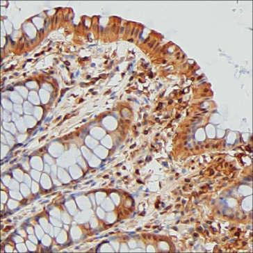 ENO1 Antibody in Immunohistochemistry (Paraffin) (IHC (P))