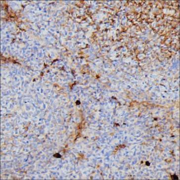 Human IgG3 Antibody in Immunohistochemistry (Paraffin) (IHC (P))