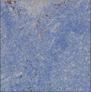 Human IgG2 Antibody in Immunohistochemistry (Paraffin) (IHC (P))