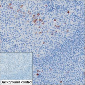 Human IgG Antibody in Immunohistochemistry (Paraffin) (IHC (P))