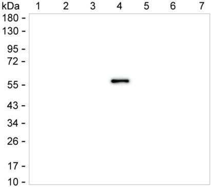 Human IgG4 Antibody in Western Blot (WB)