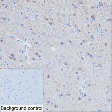 RAB11B Antibody in Immunohistochemistry (Paraffin) (IHC (P))