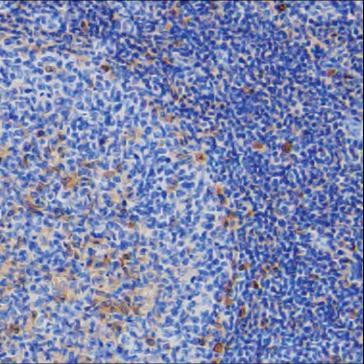 Human IgG Antibody in Immunohistochemistry (Paraffin) (IHC (P))