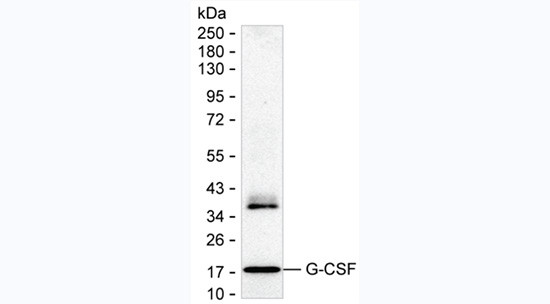 G-CSF Antibody in Western Blot (WB)