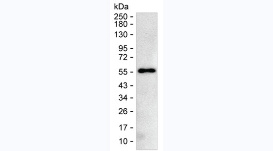 CTLA-4 Antibody in Western Blot (WB)