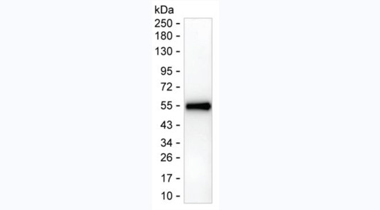 CTLA-4 Antibody in Western Blot (WB)