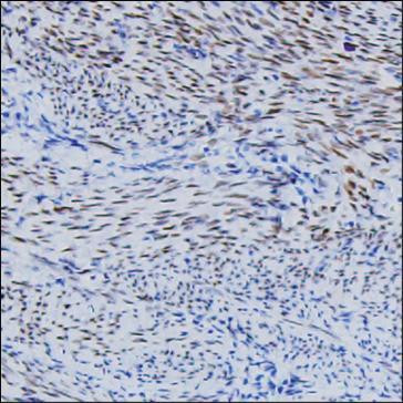 FGF2 Antibody in Immunohistochemistry (Paraffin) (IHC (P))