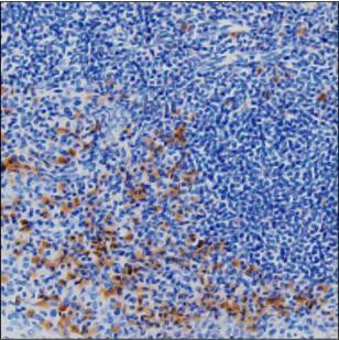 Human IgG Antibody in Immunohistochemistry (Paraffin) (IHC (P))