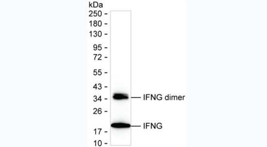 GM-CSF Antibody in ELISA (ELISA)