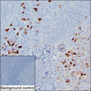 Human IgA Antibody in Immunohistochemistry (Paraffin) (IHC (P))