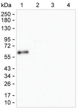 Human IgA Antibody in Western Blot (WB)