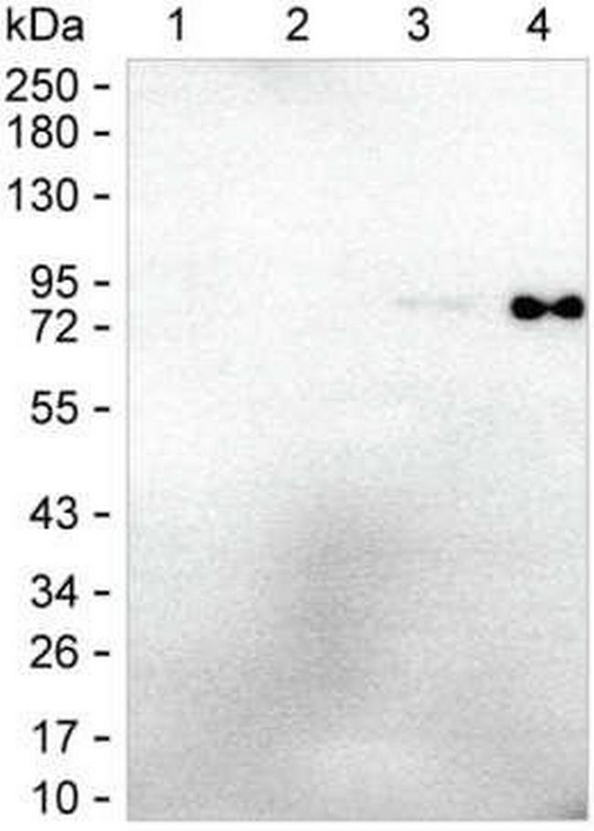 Human IgE Antibody in Western Blot (WB)