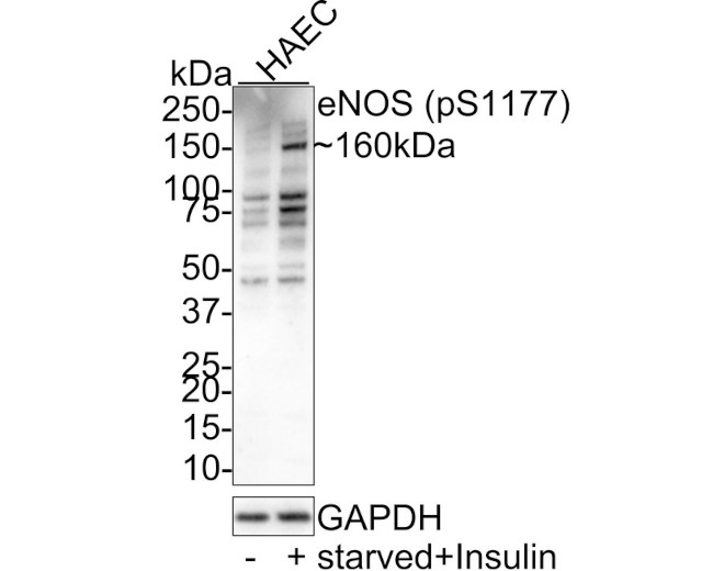 Phospho-eNOS (Ser1177) Antibody in Western Blot (WB)