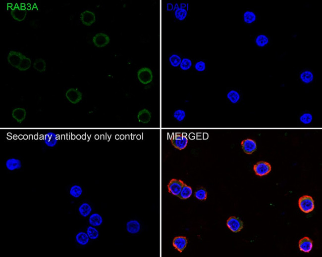 RAB3A Antibody in Immunocytochemistry (ICC/IF)