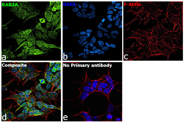 RAB3A Antibody in Immunocytochemistry (ICC/IF)