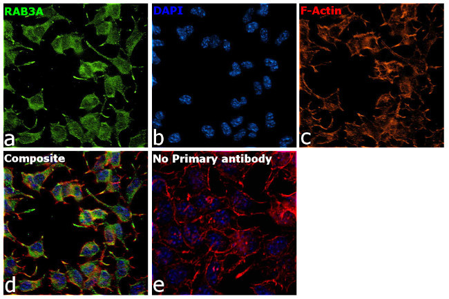 RAB3A Antibody in Immunocytochemistry (ICC/IF)