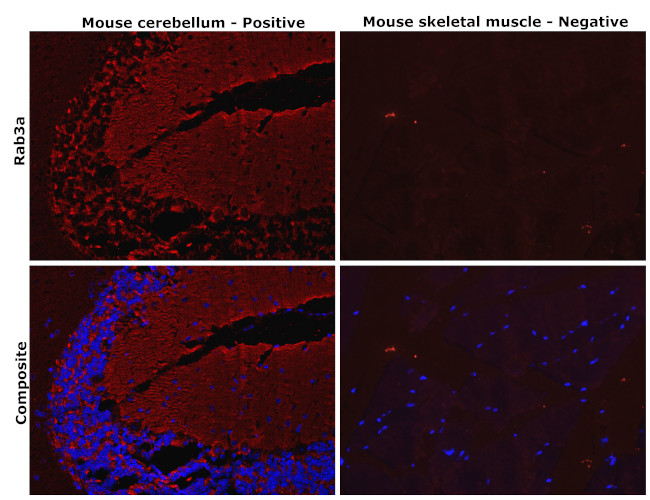 RAB3A Antibody in Immunohistochemistry (Paraffin) (IHC (P))