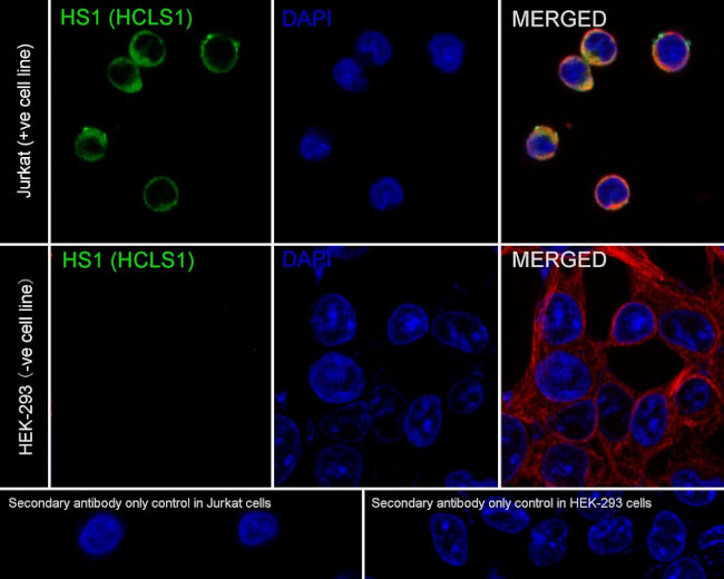 HCLS1 Antibody in Immunocytochemistry (ICC/IF)