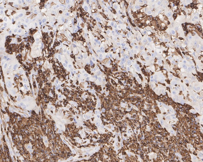 HCLS1 Antibody in Immunohistochemistry (Paraffin) (IHC (P))