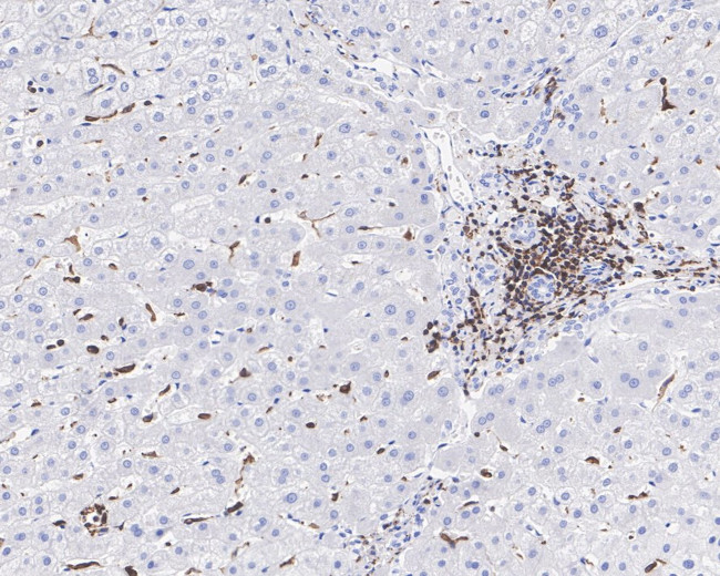 HCLS1 Antibody in Immunohistochemistry (Paraffin) (IHC (P))