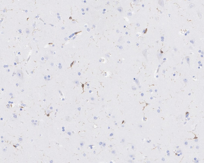 HCLS1 Antibody in Immunohistochemistry (Paraffin) (IHC (P))