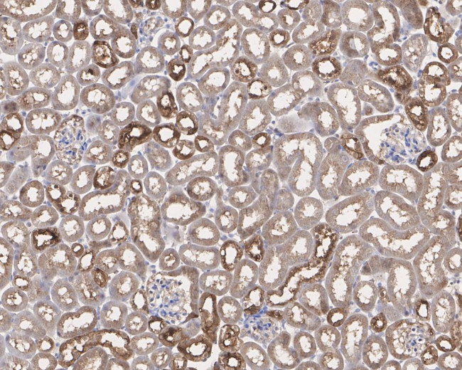 KEAP1 Antibody in Immunohistochemistry (Paraffin) (IHC (P))