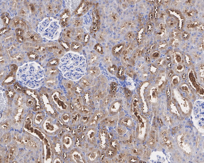 KEAP1 Antibody in Immunohistochemistry (Paraffin) (IHC (P))