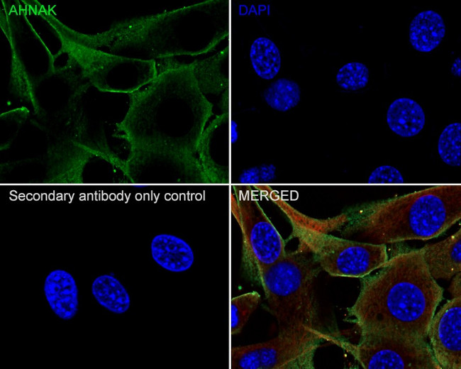 AHNAK Antibody in Immunocytochemistry (ICC/IF)