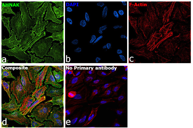 AHNAK Antibody in Immunocytochemistry (ICC/IF)