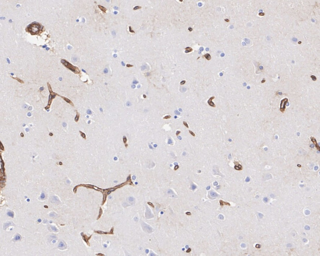 AHNAK Antibody in Immunohistochemistry (Paraffin) (IHC (P))